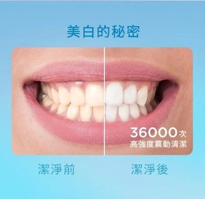 OSUMA聲波電動牙刷 OS-2202TU